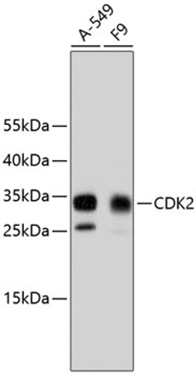 Western blot analysis of extracts of various cell lines, using CDK2 antibody (13-811) .<br/>Secondary antibody: HRP Goat Anti-Rabbit IgG (H+L) at 1:10000 dilution.<br/>Lysates/proteins: 25ug per lane.<br/>Blocking buffer: 3% nonfat dry milk in TBST.