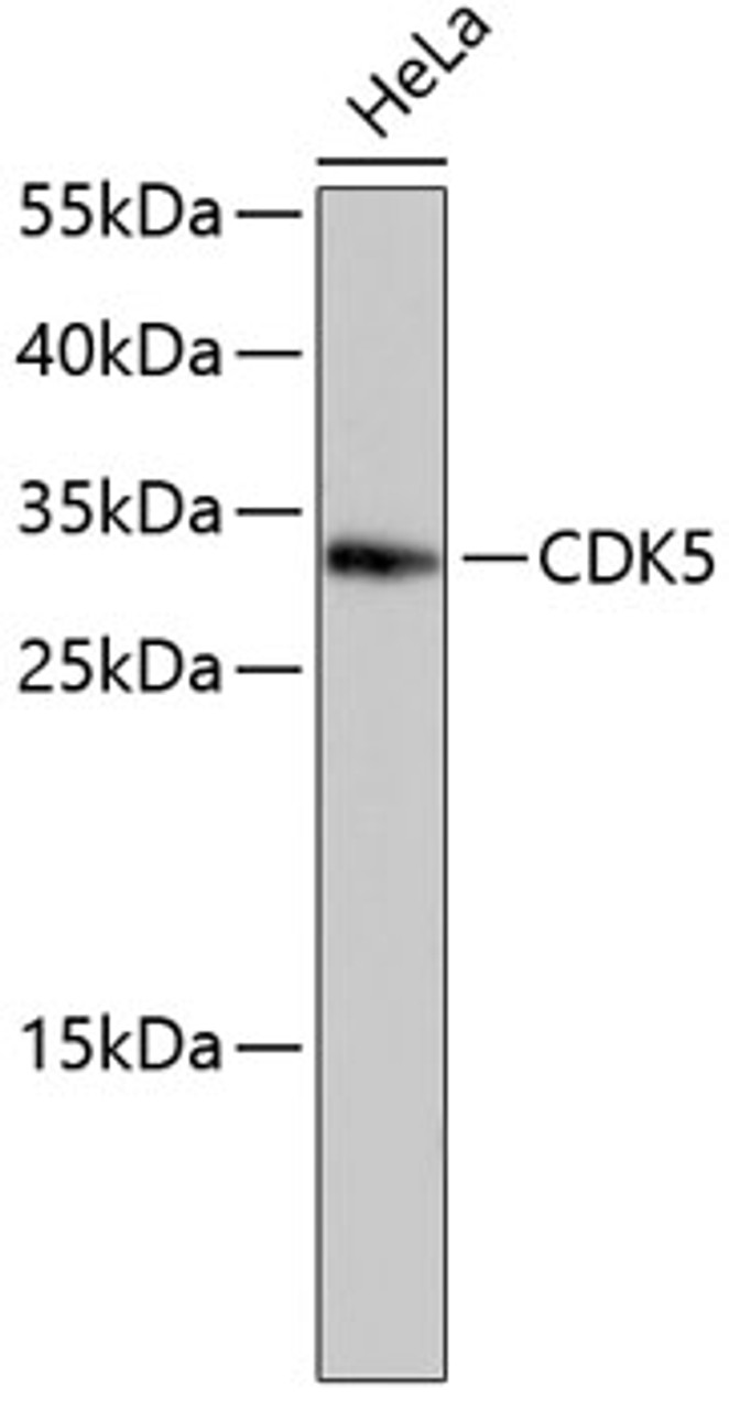 Western blot analysis of extracts of HeLa cells, using CDK5 antibody (13-813) .<br/>Secondary antibody: HRP Goat Anti-Rabbit IgG (H+L) at 1:10000 dilution.<br/>Lysates/proteins: 25ug per lane.<br/>Blocking buffer: 3% nonfat dry milk in TBST.