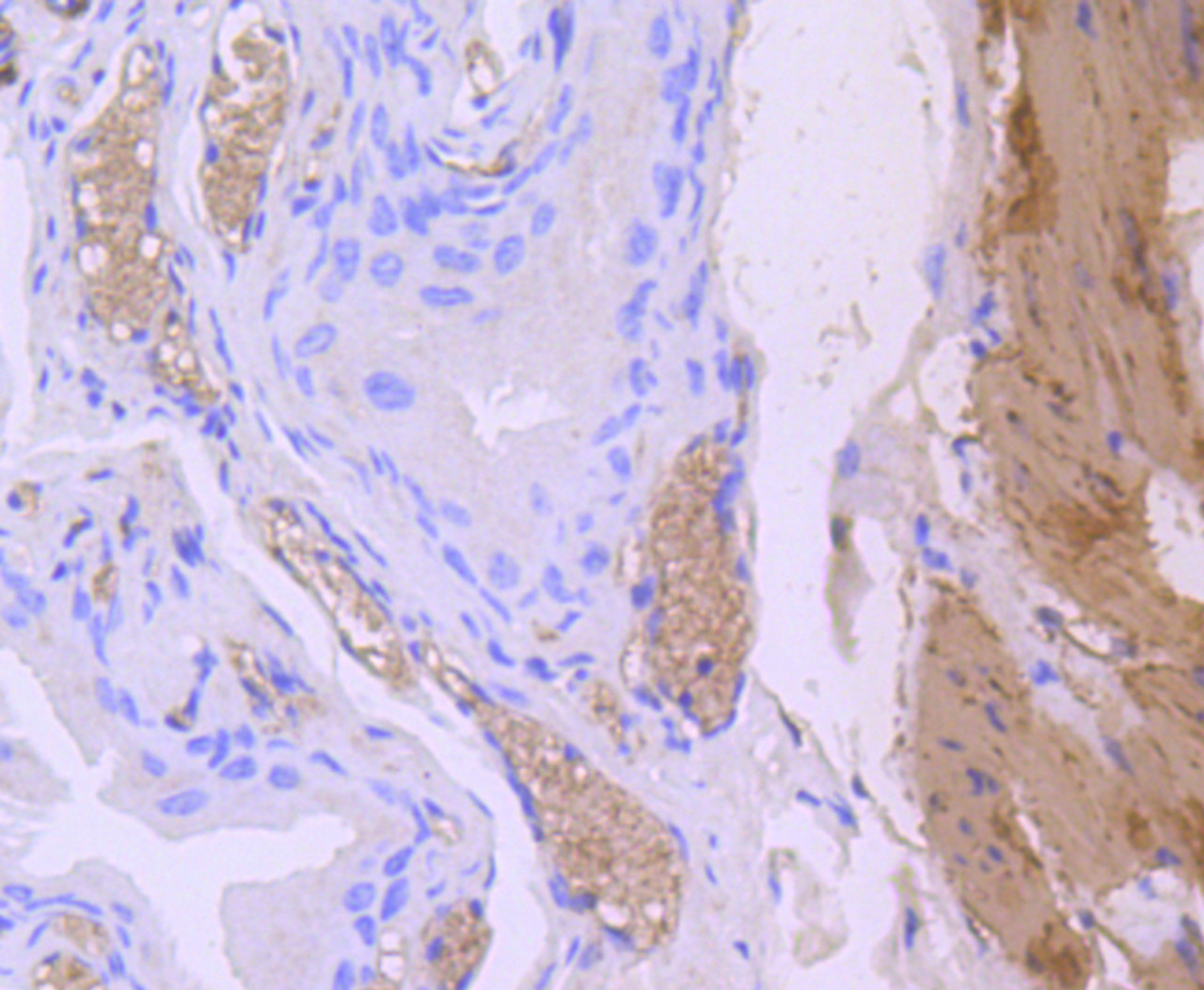 Immunohistochemistry of paraffin-embedded mouse bladder using CNN1 antibody (13-818) at dilution of 1:100 (40x lens) .