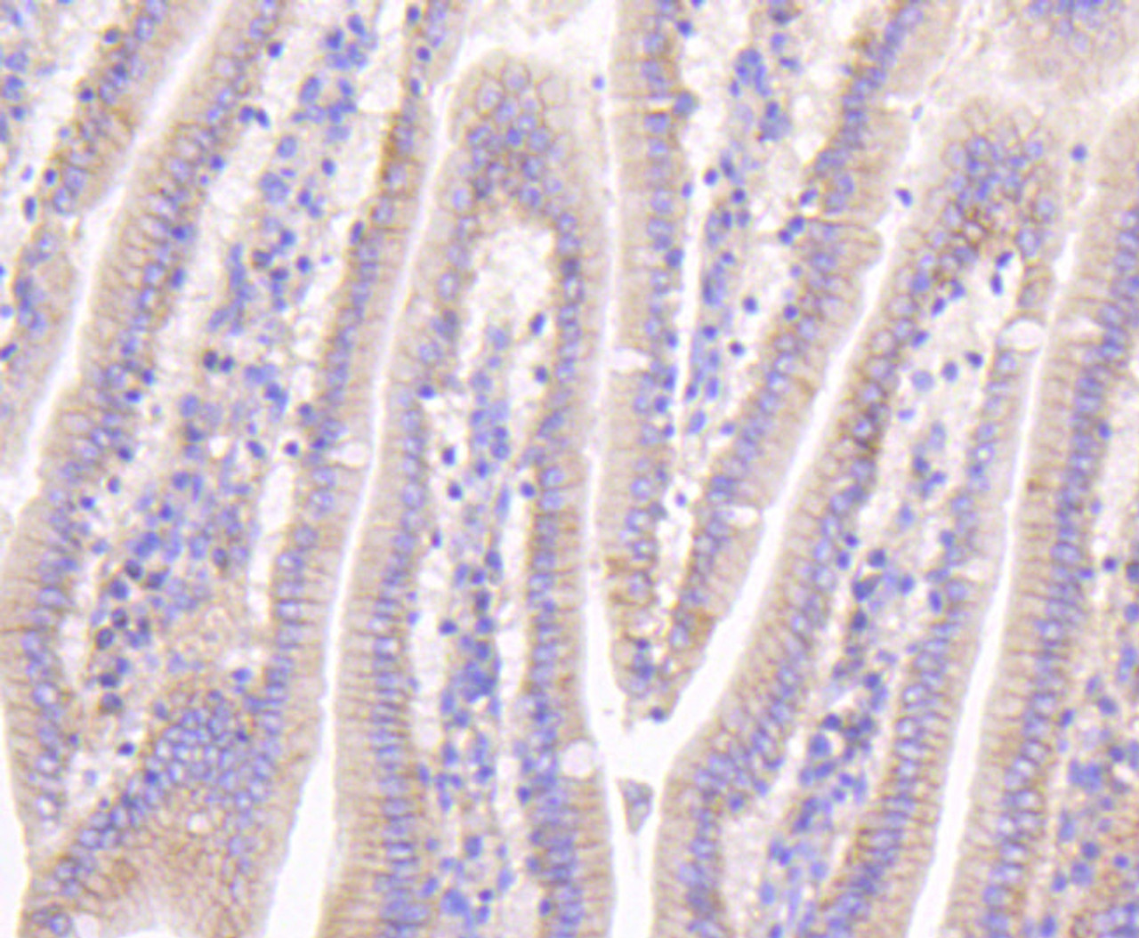 Immunohistochemistry of paraffin-embedded mouse intestin using beta Catenin antibody (13-826) at dilution of 1:100 (40x lens) .
