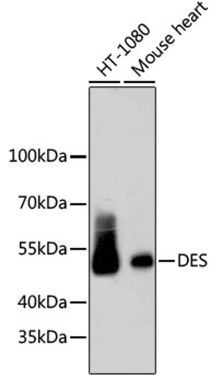 Western blot analysis of extracts of various cell lines, using DES antibody (13-827) .<br/>Secondary antibody: HRP Goat Anti-Rabbit IgG (H+L) at 1:10000 dilution.<br/>Lysates/proteins: 25ug per lane.<br/>Blocking buffer: 3% nonfat dry milk in TBST.