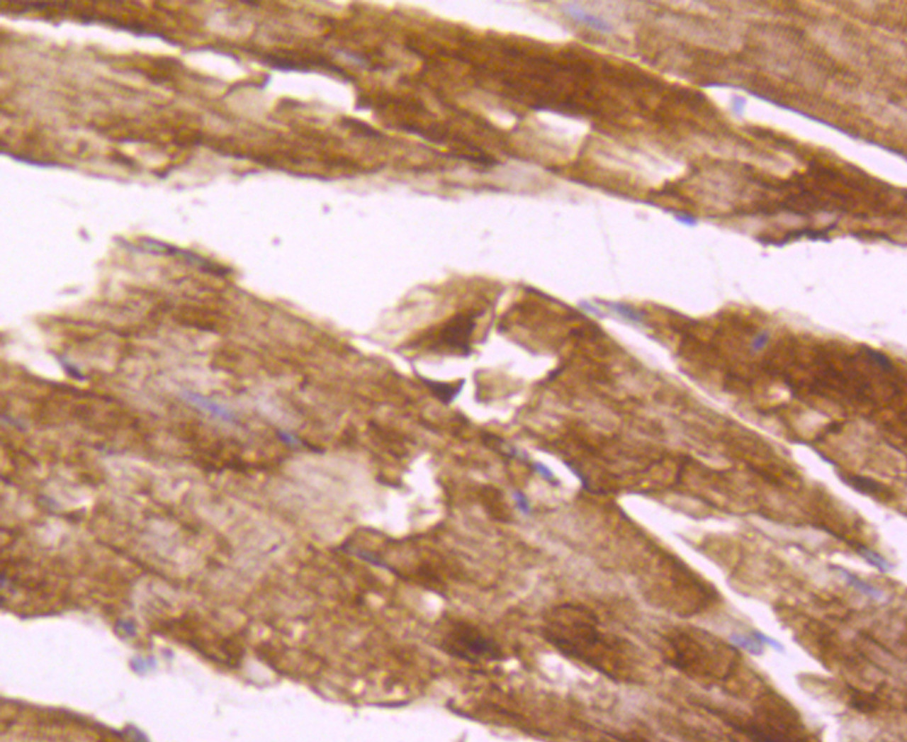 Immunohistochemistry of paraffin-embedded mouse skeletal muscle using DES antibody (13-827) at dilution of 1:100 (40x lens) .