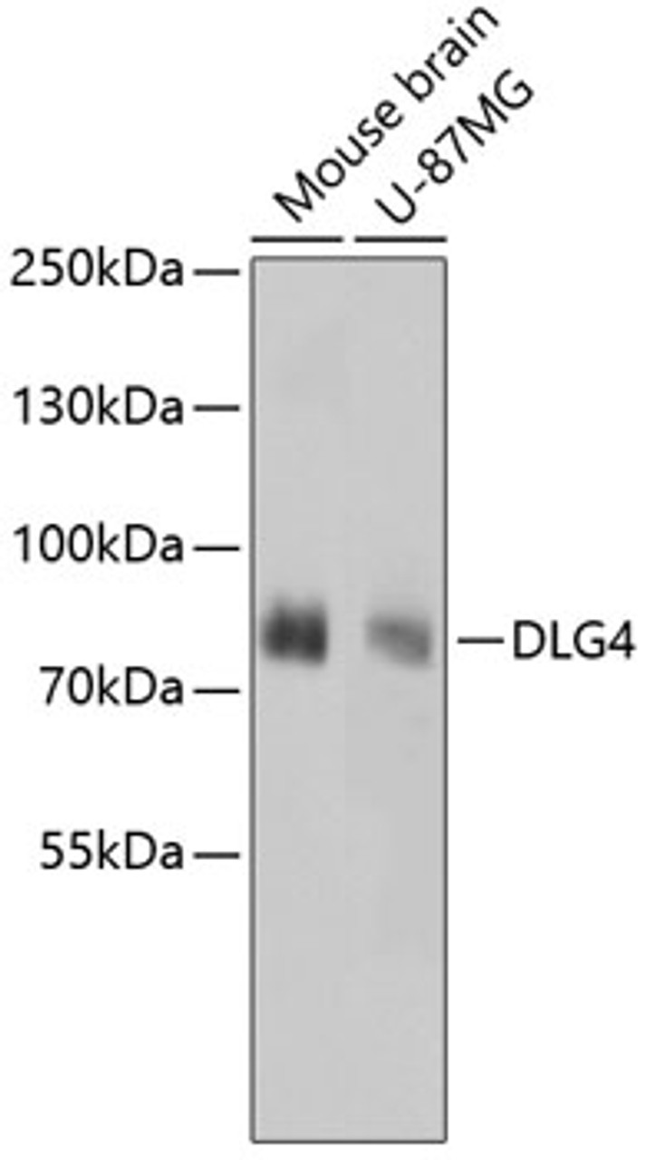 Western blot analysis of extracts of various cell lines, using DLG4 antibody (13-831) .<br/>Secondary antibody: HRP Goat Anti-Rabbit IgG (H+L) at 1:10000 dilution.<br/>Lysates/proteins: 25ug per lane.<br/>Blocking buffer: 3% nonfat dry milk in TBST.