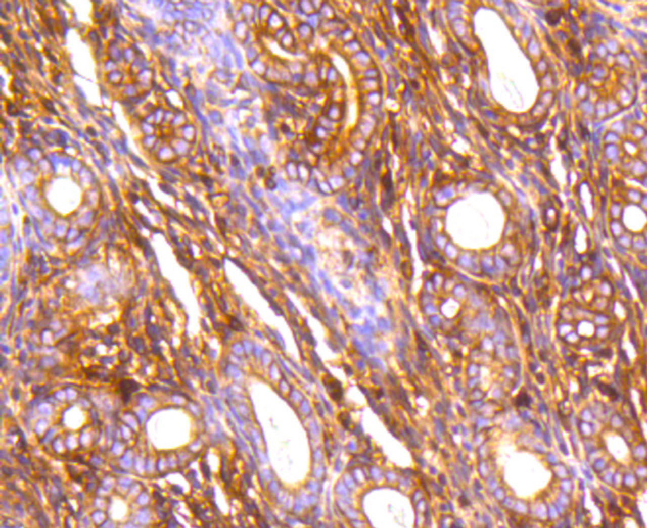 Immunohistochemistry of paraffin-embedded mouse uterus using FLNA antibody (13-840) at dilution of 1:100 (40x lens) .