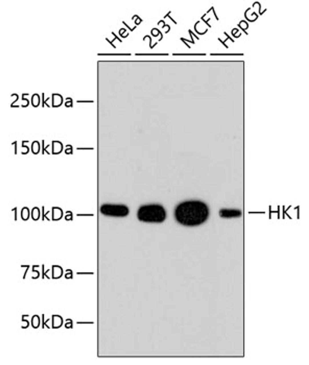 Western blot analysis of extracts of various cell lines, using HK1 antibody (13-849) .<br/>Secondary antibody: HRP Goat Anti-Rabbit IgG (H+L) at 1:10000 dilution.<br/>Lysates/proteins: 25ug per lane.<br/>Blocking buffer: 3% nonfat dry milk in TBST.