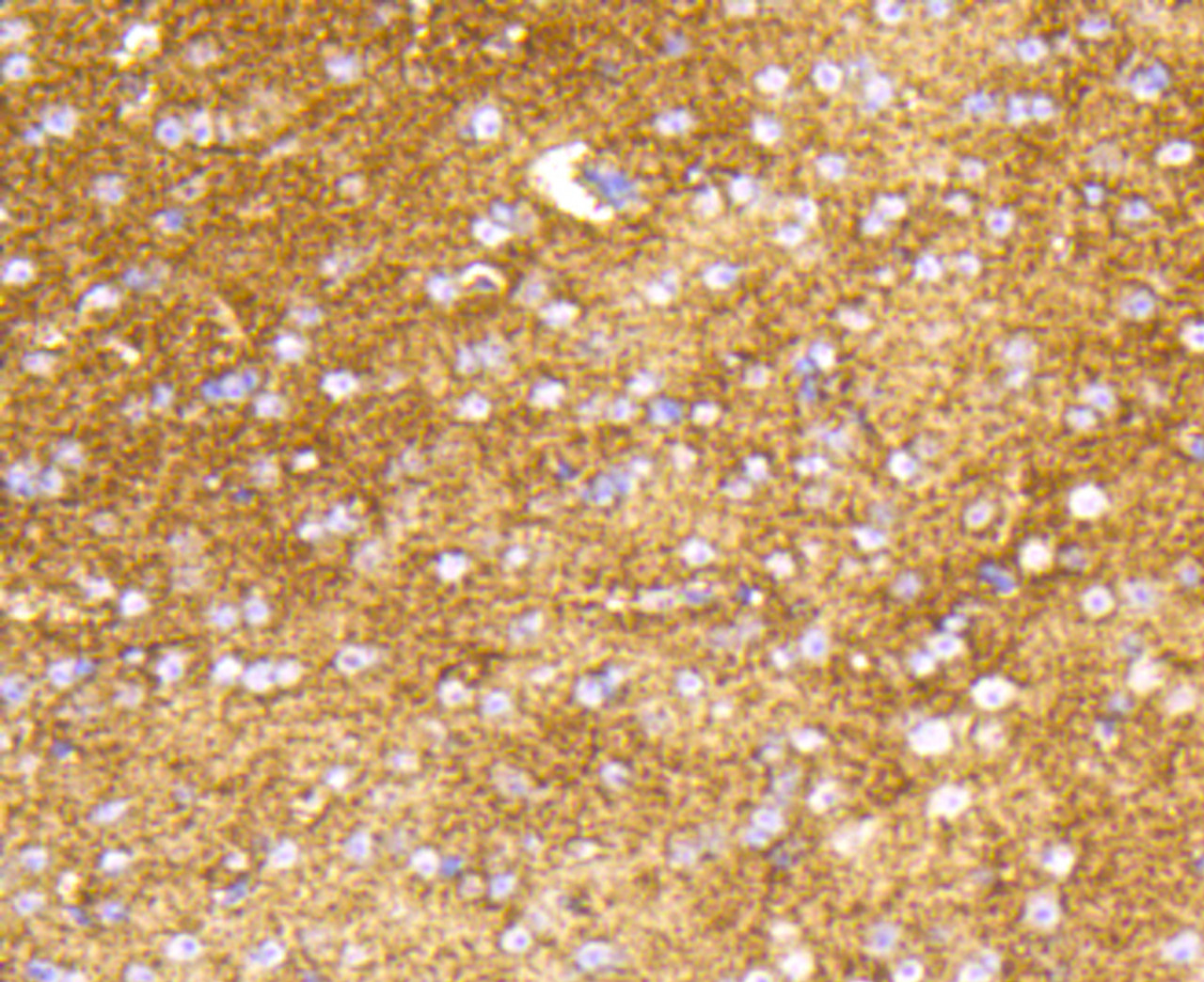 Immunohistochemistry of paraffin-embedded mouse brain using HK1 antibody (13-849) at dilution of 1:100 (40x lens) .