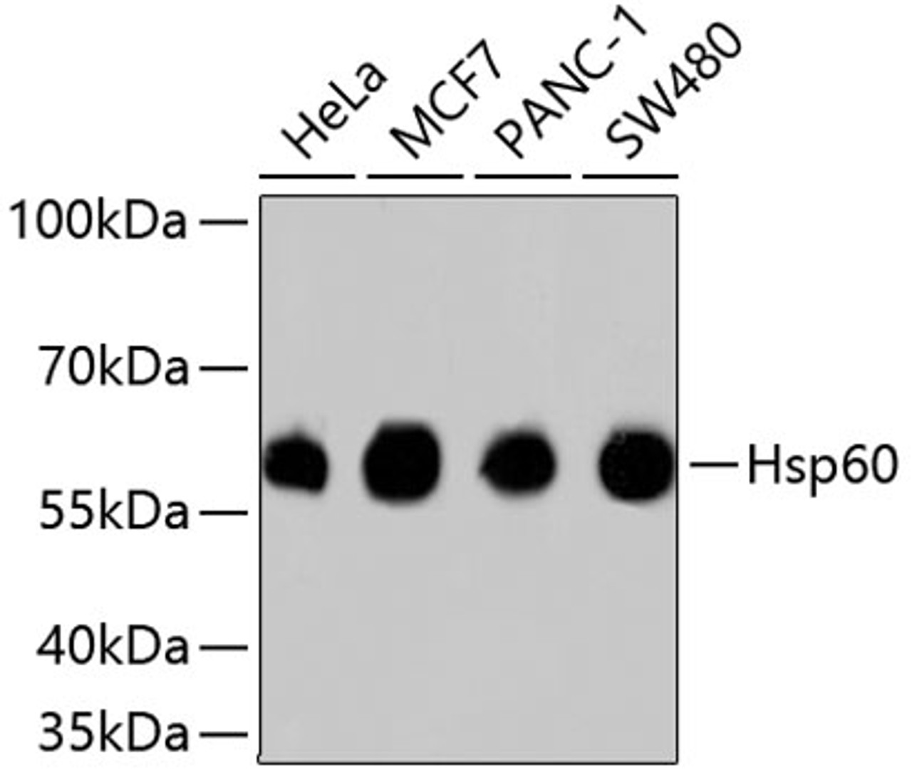 Western blot analysis of extracts of various cell lines, using Hsp60 antibody (13-854) .<br/>Secondary antibody: HRP Goat Anti-Rabbit IgG (H+L) at 1:10000 dilution.<br/>Lysates/proteins: 25ug per lane.<br/>Blocking buffer: 3% nonfat dry milk in TBST.