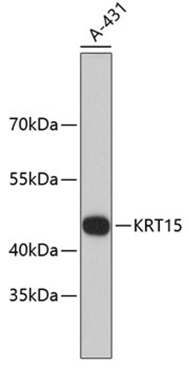 Western blot analysis of extracts of A-431 cells, using KRT15 antibody (13-863) .<br/>Secondary antibody: HRP Goat Anti-Rabbit IgG (H+L) at 1:10000 dilution.<br/>Lysates/proteins: 25ug per lane.<br/>Blocking buffer: 3% nonfat dry milk in TBST.