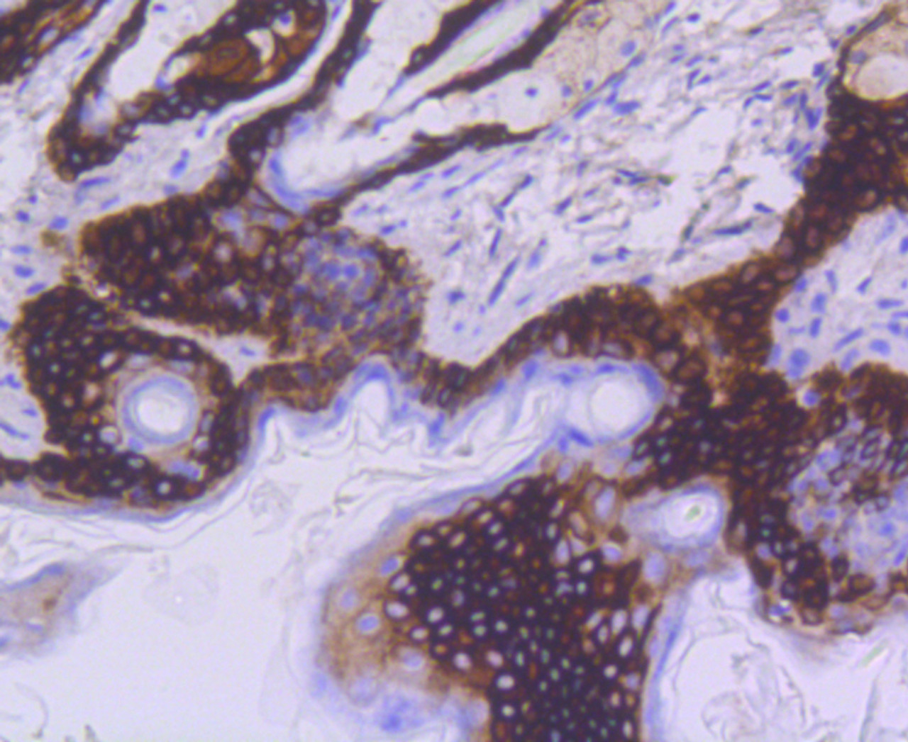 Immunohistochemistry of paraffin-embedded mouse skin using KRT15 antibody (13-863) at dilution of 1:100 (40x lens) .