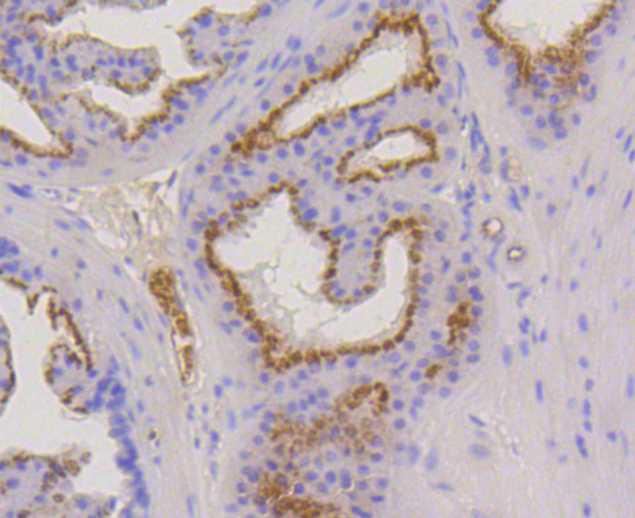 Immunohistochemistry of paraffin-embedded mouse prostate using KRT17 antibody (13-865) at dilution of 1:100 (40x lens) .