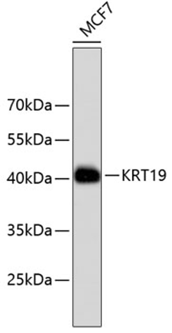 Western blot analysis of extracts of MCF-7 cells, using KRT19 antibody (13-866) .<br/>Secondary antibody: HRP Goat Anti-Rabbit IgG (H+L) at 1:10000 dilution.<br/>Lysates/proteins: 25ug per lane.<br/>Blocking buffer: 3% nonfat dry milk in TBST.