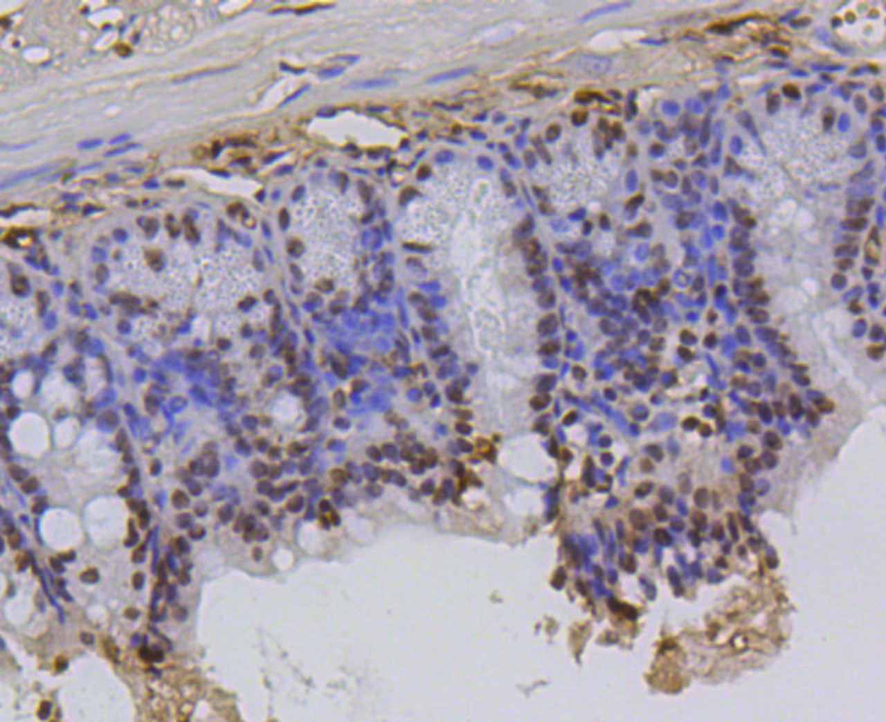 Immunohistochemistry of paraffin-embedded mouse colon using Hydroxyl-Histone H2A-Y39 antibody (13-880) at dilution of 1:100 (40x lens) .