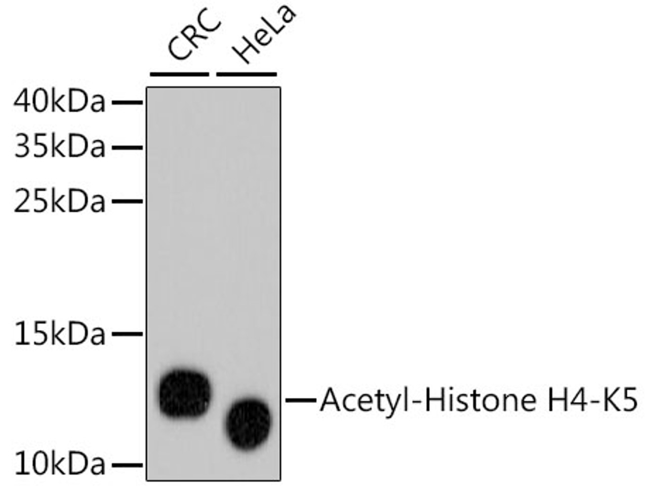 Western blot analysis of extracts of various cell lines, using Acetyl-Histone H4-K5 antibody (13-884) .<br/>Secondary antibody: HRP Goat Anti-Rabbit IgG (H+L) at 1:10000 dilution.<br/>Lysates/proteins: 25ug per lane.<br/>Blocking buffer: 3% nonfat dry milk in TBST.