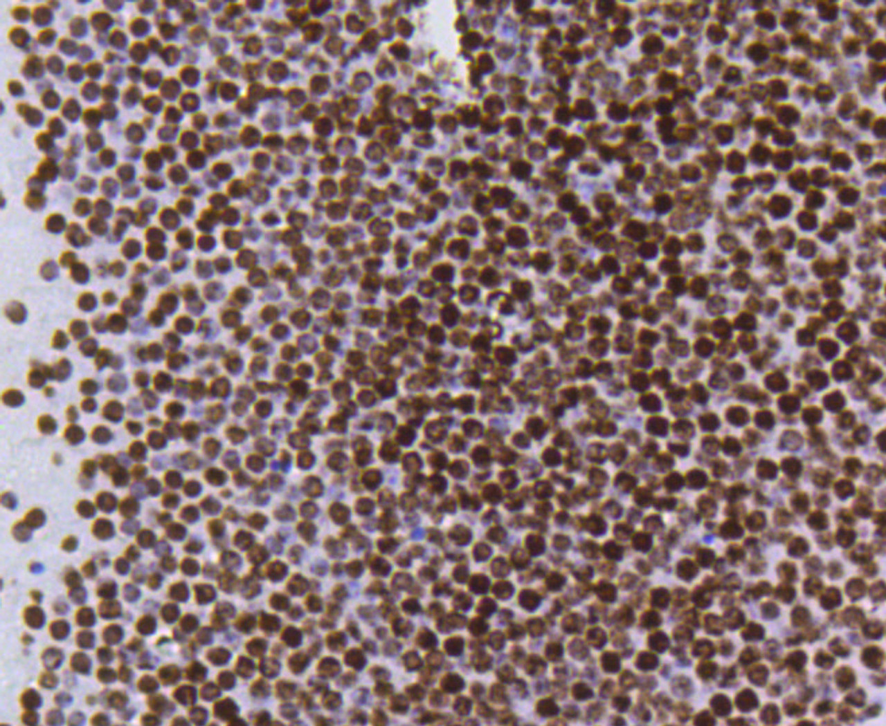 Immunohistochemistry of paraffin-embedded mouse brain using Acetyl-Histone H4-K5 antibody (13-884) at dilution of 1:100 (40x lens) .