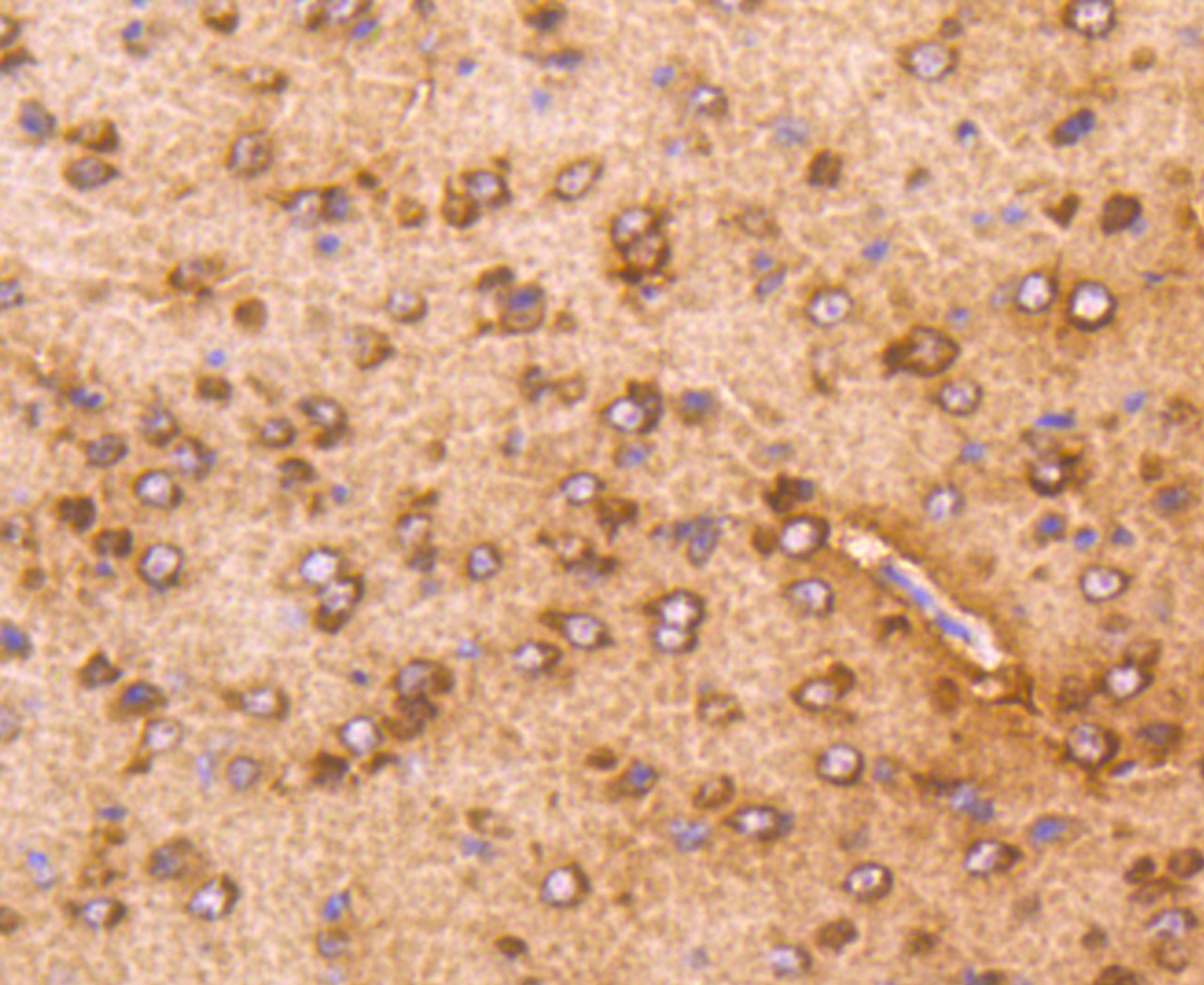 Immunohistochemistry of paraffin-embedded mouse brain using AKT1 antibody (13-891) at dilution of 1:100 (40x lens) .