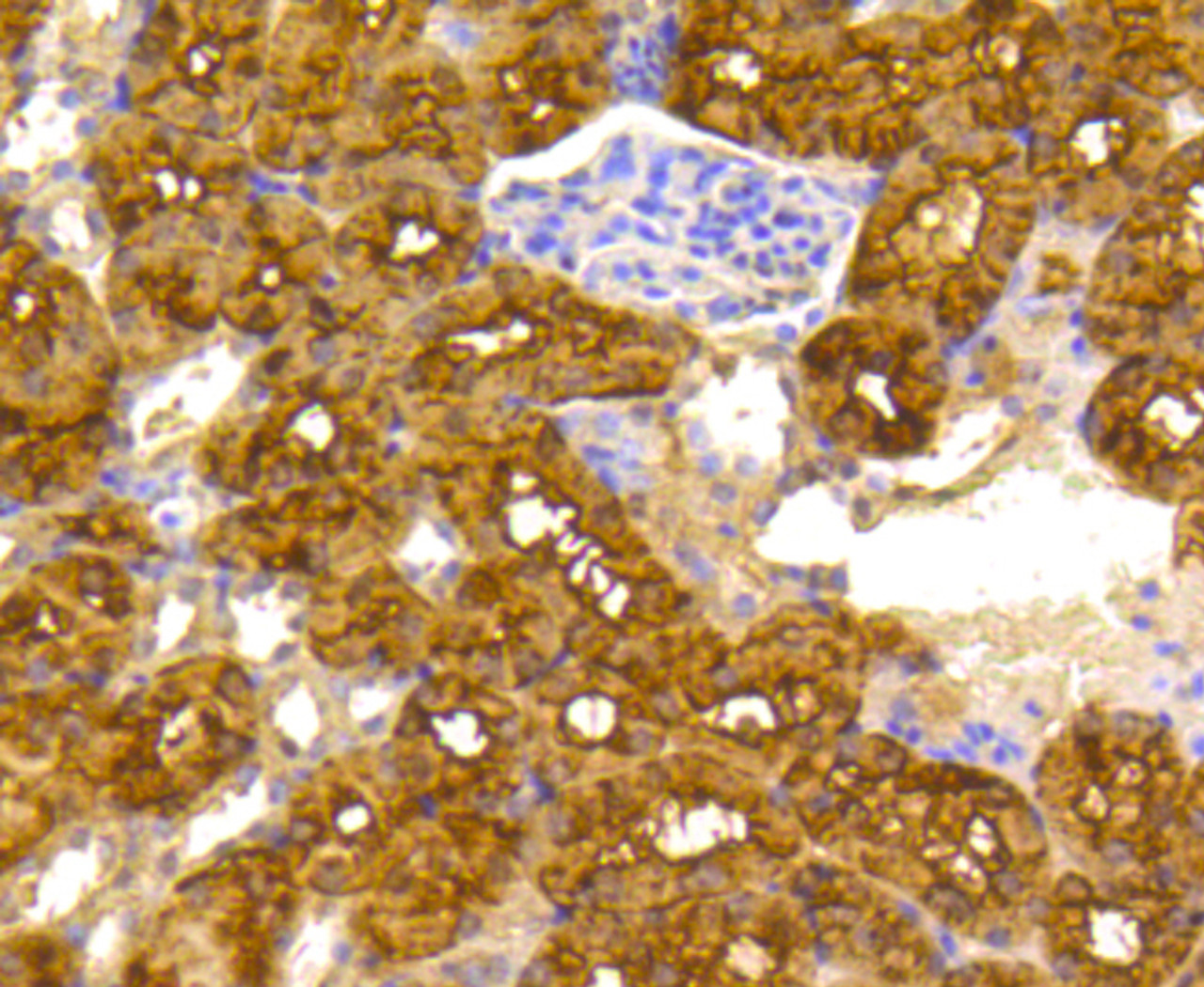 Immunohistochemistry of paraffin-embedded mouse kidney using ACLY antibody (13-913) at dilution of 1:100 (40x lens) .