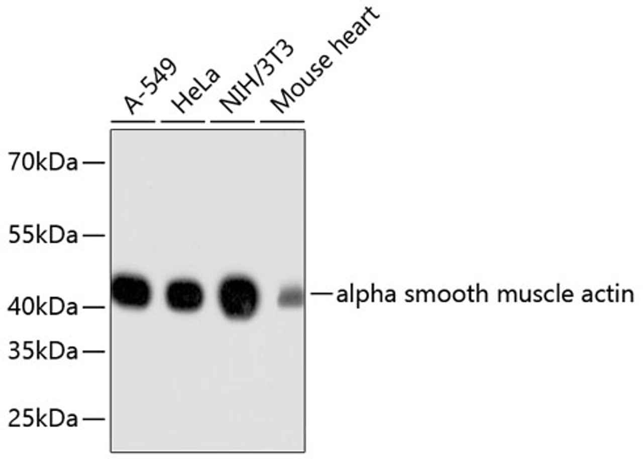 Western blot analysis of extracts of various cell lines, using alpha smooth muscle actin antibody (13-917) .<br/>Secondary antibody: HRP Goat Anti-Rabbit IgG (H+L) at 1:10000 dilution.<br/>Lysates/proteins: 25ug per lane.<br/>Blocking buffer: 3% nonfat dry milk in TBST.