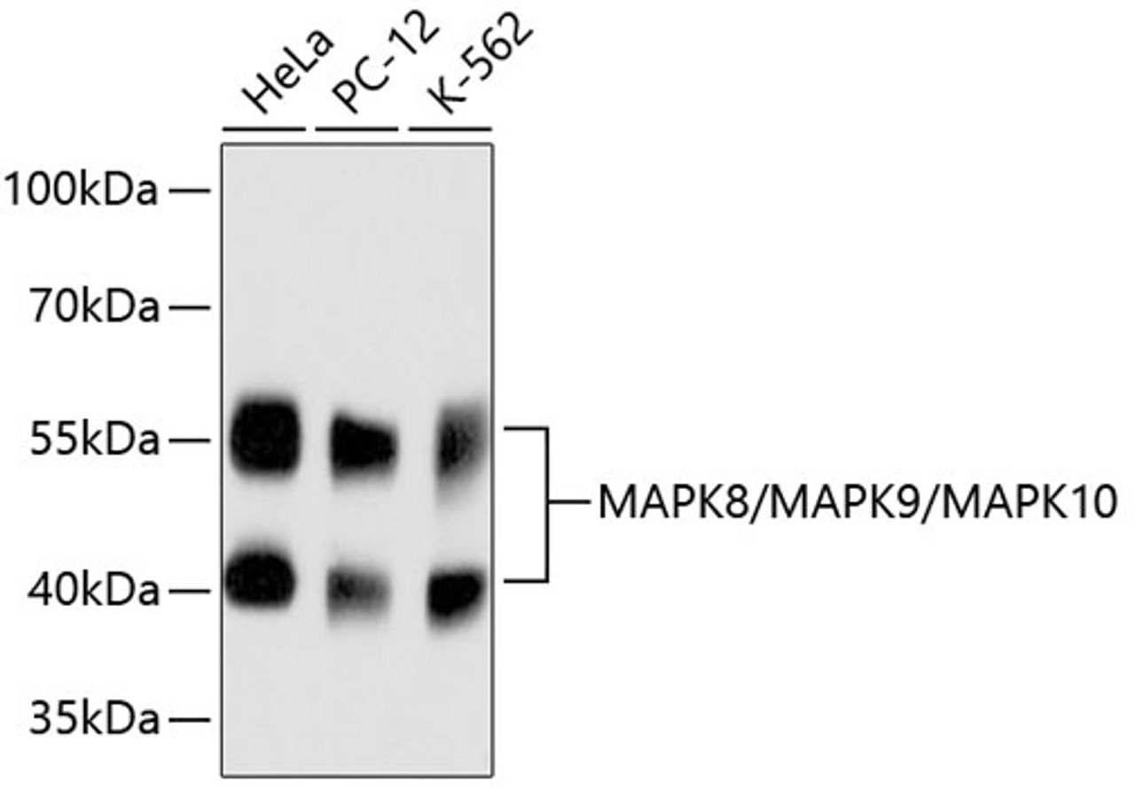 Western blot analysis of extracts of various cell lines, using MAPK8/MAPK9/MAPK10 antibody (13-920) .<br/>Secondary antibody: HRP Goat Anti-Rabbit IgG (H+L) at 1:10000 dilution.<br/>Lysates/proteins: 25ug per lane.<br/>Blocking buffer: 3% nonfat dry milk in TBST.