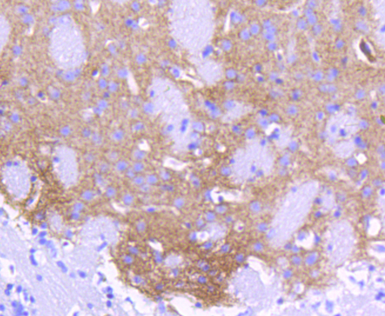 Immunohistochemistry of paraffin-embedded mouse brain using ALDH1A1 antibody (13-927) at dilution of 1:100 (40x lens) .