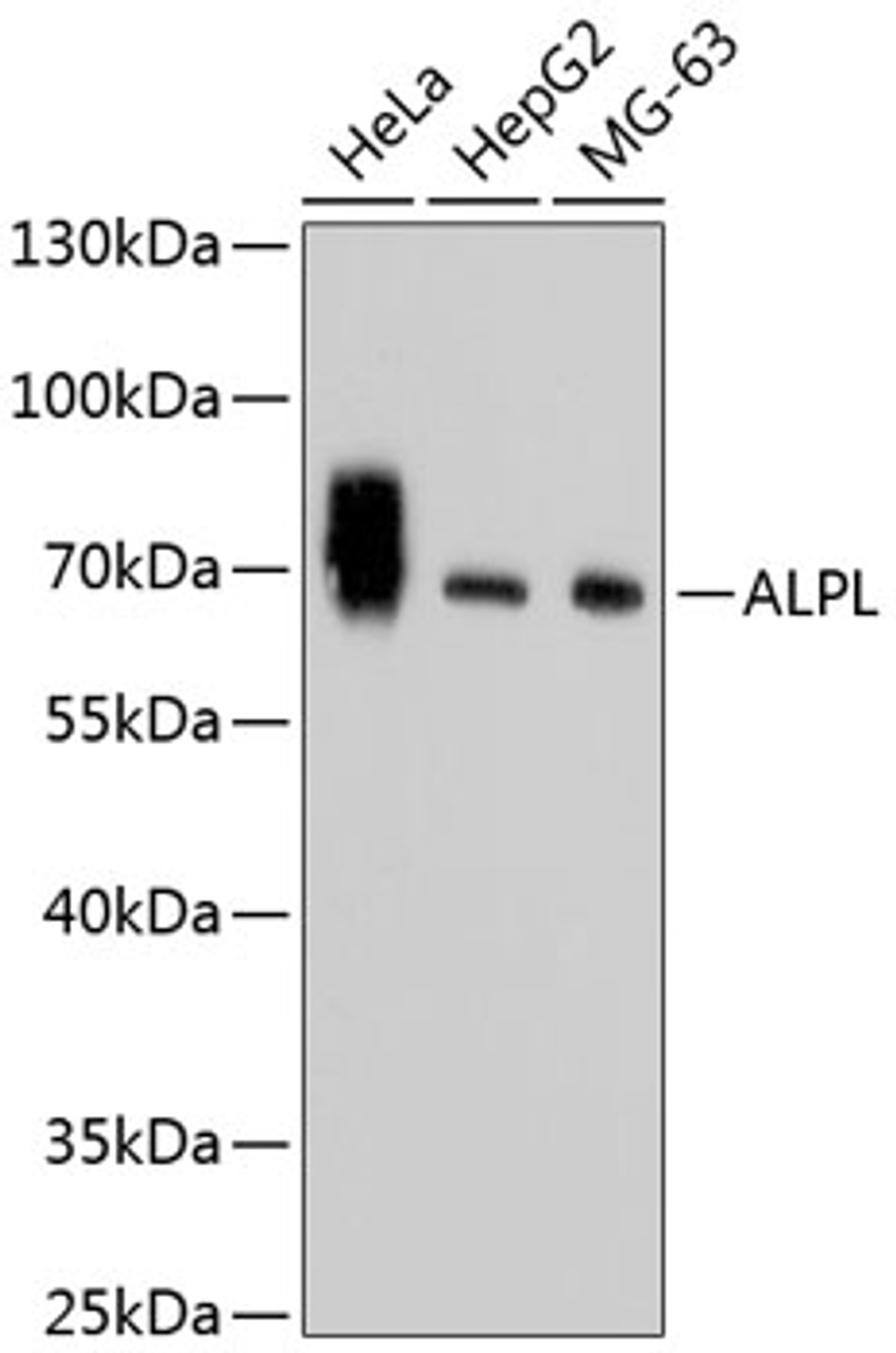 Western blot analysis of extracts of various cell lines, using ALPL antibody (13-929) .<br/>Secondary antibody: HRP Goat Anti-Rabbit IgG (H+L) at 1:10000 dilution.<br/>Lysates/proteins: 25ug per lane.<br/>Blocking buffer: 3% nonfat dry milk in TBST.