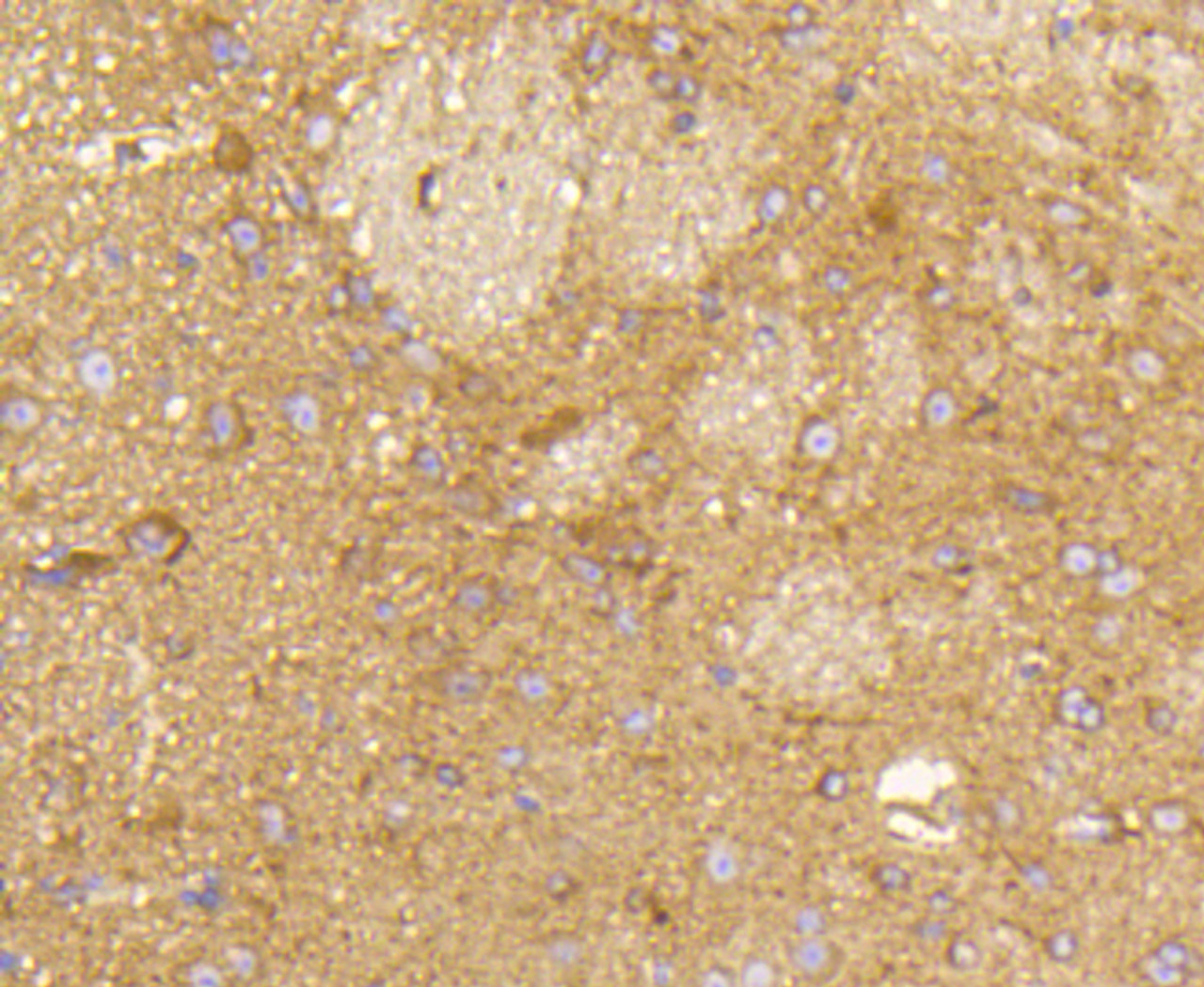 Immunohistochemistry of paraffin-embedded mouse brain using RAB5A antibody (13-932) at dilution of 1:100 (40x lens) .