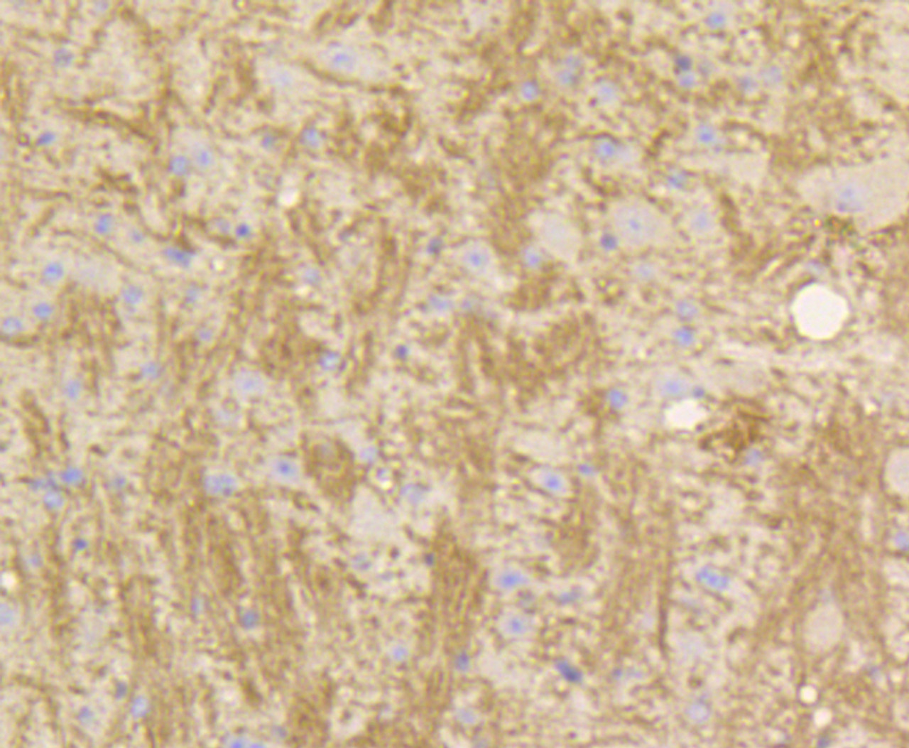 Immunohistochemistry of paraffin-embedded mouse brain using STAT3 antibody (13-949) at dilution of 1:100 (40x lens) .