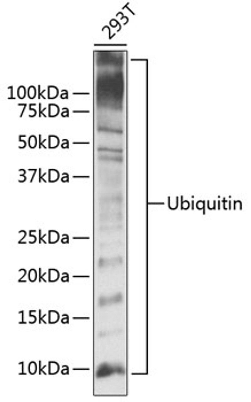 Western blot analysis of extracts of 293T cells, using Ubiquitin antibody (13-957) .<br/>Secondary antibody: HRP Goat Anti-Rabbit IgG (H+L) at 1:10000 dilution.<br/>Lysates/proteins: 25ug per lane.<br/>Blocking buffer: 3% nonfat dry milk in TBST.