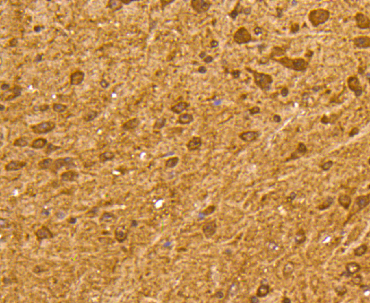 Immunohistochemistry of paraffin-embedded mouse brain using Ubiquitin antibody (13-957) at dilution of 1:100 (40x lens) .