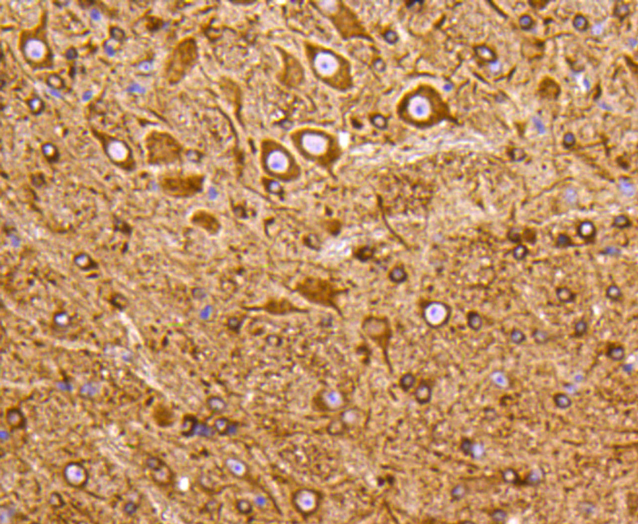 Immunohistochemistry of paraffin-embedded mouse brain using PIK3R3 antibody (13-965) at dilution of 1:100 (40x lens) .