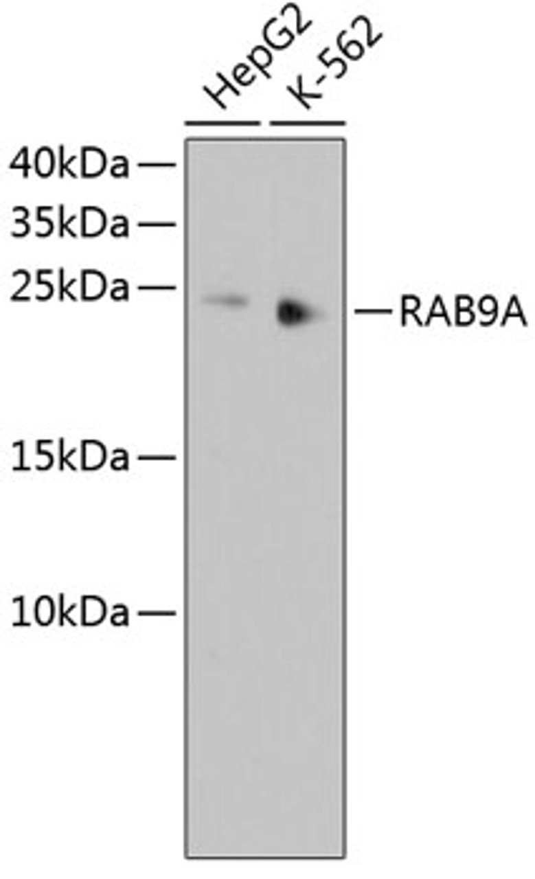 Western blot analysis of extracts of various cell lines, using RAB9A antibody (13-975) .<br/>Secondary antibody: HRP Goat Anti-Rabbit IgG (H+L) at 1:10000 dilution.<br/>Lysates/proteins: 25ug per lane.<br/>Blocking buffer: 3% nonfat dry milk in TBST.
