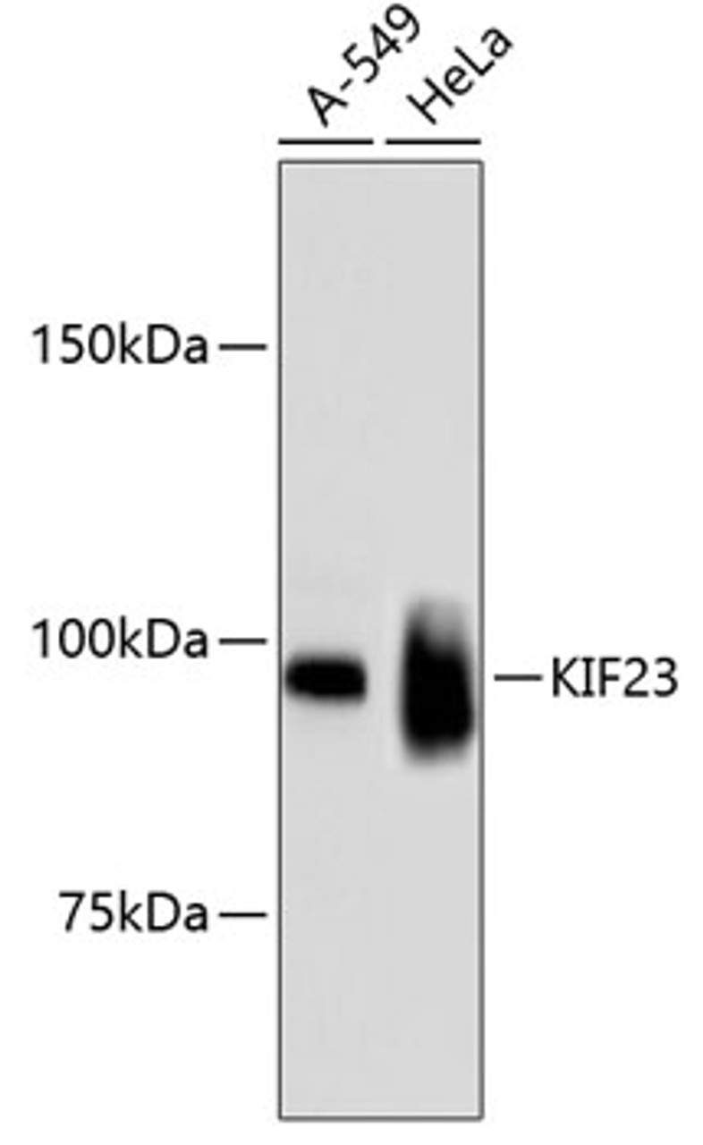 Western blot analysis of extracts of various cell lines, using KIF23 antibody (13-976) .<br/>Secondary antibody: HRP Goat Anti-Rabbit IgG (H+L) at 1:10000 dilution.<br/>Lysates/proteins: 25ug per lane.<br/>Blocking buffer: 3% nonfat dry milk in TBST.