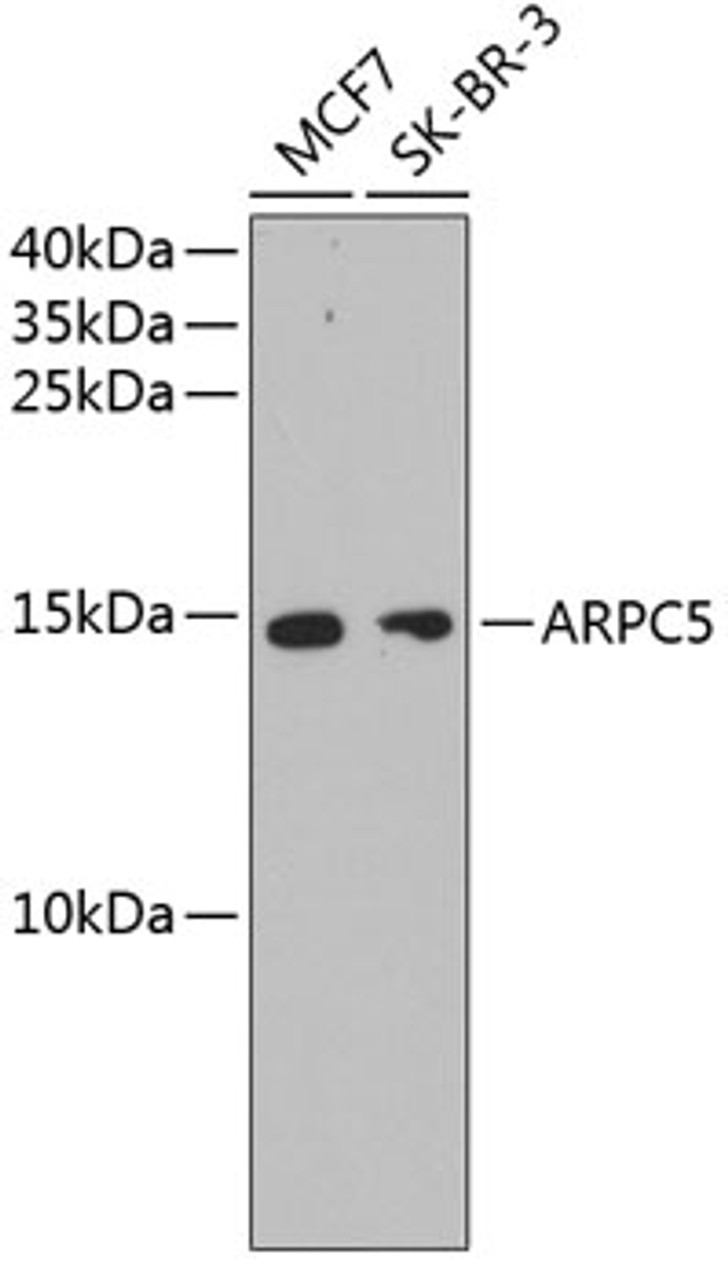 Western blot analysis of extracts of various cell lines, using ARPC5 antibody (13-981) .<br/>Secondary antibody: HRP Goat Anti-Rabbit IgG (H+L) at 1:10000 dilution.<br/>Lysates/proteins: 25ug per lane.<br/>Blocking buffer: 3% nonfat dry milk in TBST.