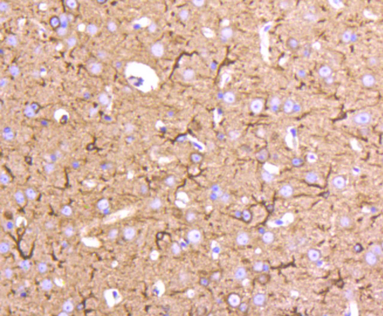 Immunohistochemistry of paraffin-embedded mouse brain using Tubulin Beta 2 antibody (13-983) at dilution of 1:100 (40x lens) .