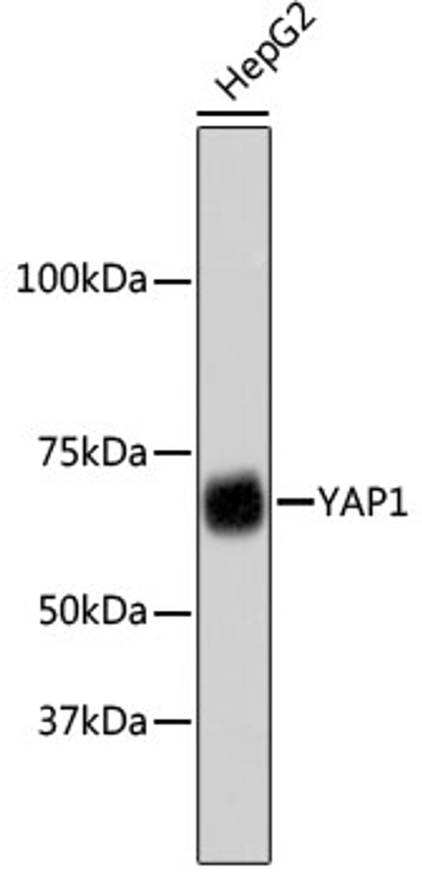 Western blot analysis of extracts of HepG2 cells, using YAP1 antibody (13-985) .<br/>Secondary antibody: HRP Goat Anti-Rabbit IgG (H+L) at 1:10000 dilution.<br/>Lysates/proteins: 25ug per lane.<br/>Blocking buffer: 3% nonfat dry milk in TBST.