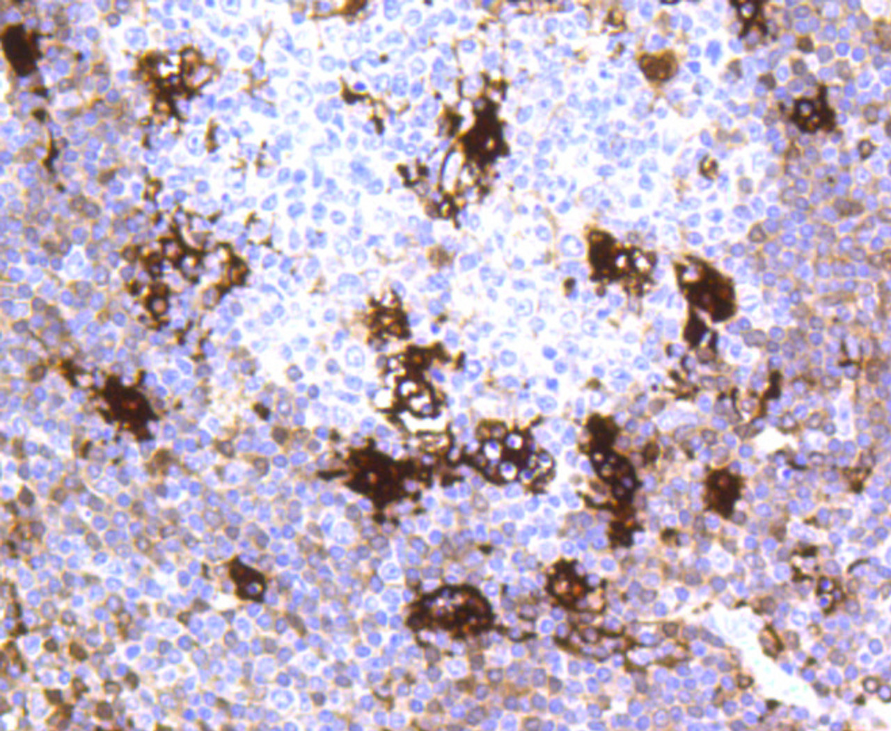 Immunohistochemistry of paraffin-embedded human tonsil using MERTK antibody (13-990) at dilution of 1:100 (40x lens) .