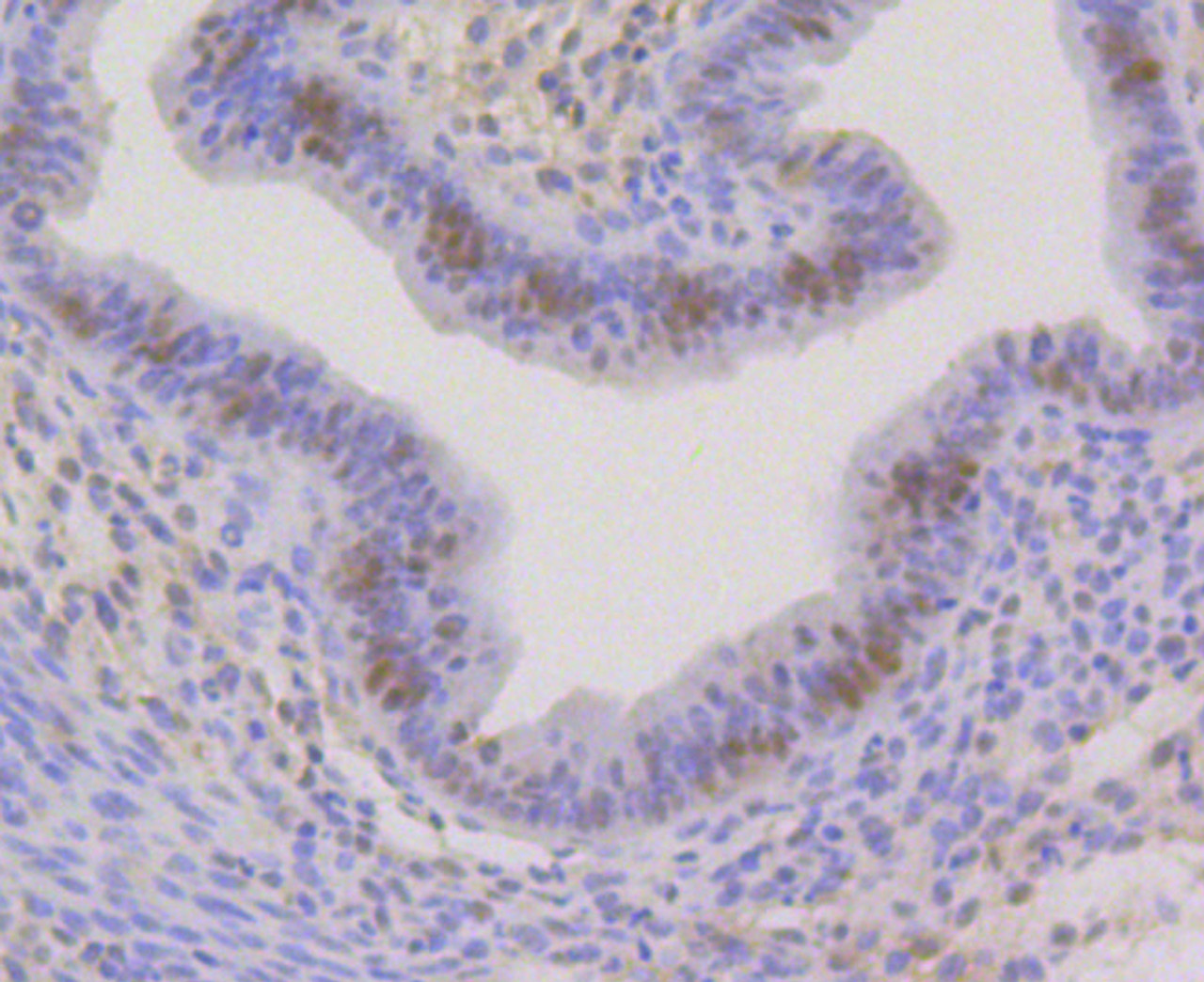 Immunohistochemistry of paraffin-embedded mouse uterus using CBX5 antibody (13-998) at dilution of 1:100 (40x lens) .
