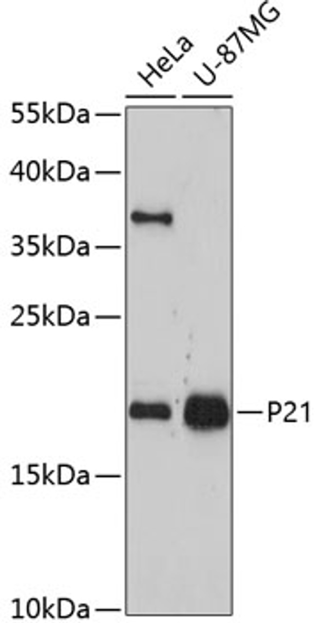 Western blot analysis of extracts of various cell lines, using P21 antibody (14-180) at 1:1000 dilution.<br/>Secondary antibody: HRP Goat Anti-Rabbit IgG (H+L) at 1:10000 dilution.<br/>Lysates/proteins: 25ug per lane.<br/>Blocking buffer: 3% nonfat dry milk in TBST.<br/>Detection: ECL Enhanced Kit.<br/>Exposure time: 90s.