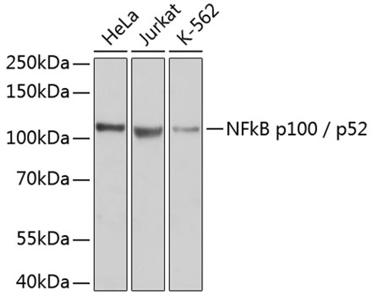 Western blot analysis of extracts of various cell lines, using NFkB p100 / p52 antibody (14-187) .<br/>Secondary antibody: HRP Goat Anti-Rabbit IgG (H+L) at 1:10000 dilution.<br/>Lysates/proteins: 25ug per lane.<br/>Blocking buffer: 3% nonfat dry milk in TBST.