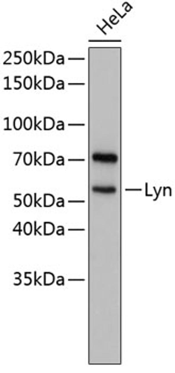 Western blot analysis of extracts of HeLa cells, using Lyn antibody (14-197) .<br/>Secondary antibody: HRP Goat Anti-Rabbit IgG (H+L) at 1:10000 dilution.<br/>Lysates/proteins: 25ug per lane.<br/>Blocking buffer: 3% nonfat dry milk in TBST.