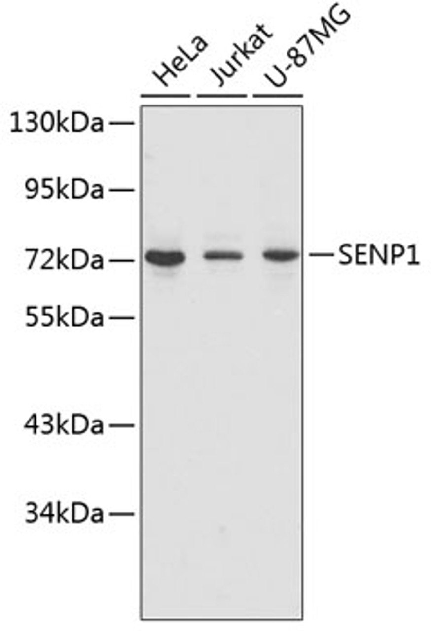 Western blot analysis of extracts of various cell lines, using SENP1 antibody (14-534) .<br/>Secondary antibody: HRP Goat Anti-Rabbit IgG (H+L) at 1:10000 dilution.<br/>Lysates/proteins: 25ug per lane.<br/>Blocking buffer: 3% nonfat dry milk in TBST.