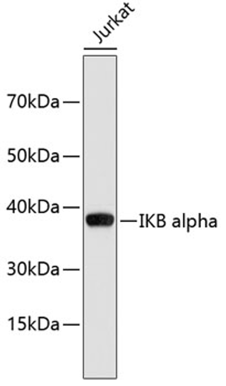 Western blot analysis of extracts of Jurkat cells, using IKB alpha antibody (18-655) .<br/>Secondary antibody: HRP Goat Anti-Rabbit IgG (H+L) at 1:10000 dilution.<br/>Lysates/proteins: 25ug per lane.<br/>Blocking buffer: 3% nonfat dry milk in TBST.
