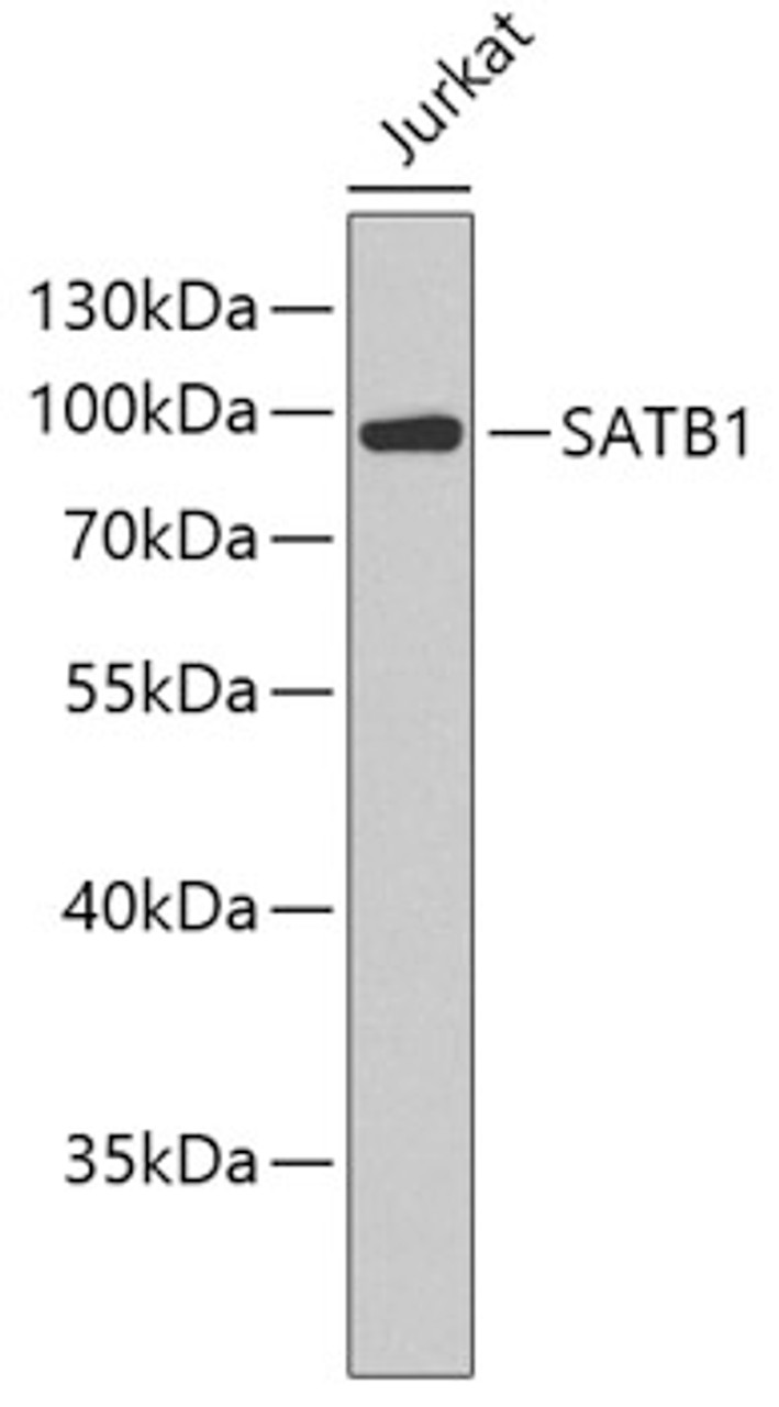 Western blot analysis of extracts of Jurkat cells, using SATB1 antibody (18-734) .<br/>Secondary antibody: HRP Goat Anti-Rabbit IgG (H+L) at 1:10000 dilution.<br/>Lysates/proteins: 25ug per lane.<br/>Blocking buffer: 3% nonfat dry milk in TBST.