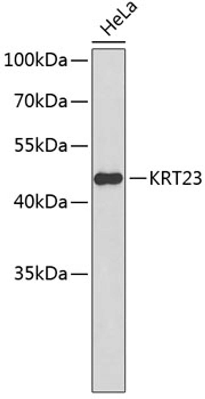 Western blot analysis of extracts of HeLa cells, using KRT23 antibody (18-756) .<br/>Secondary antibody: HRP Goat Anti-Rabbit IgG (H+L) at 1:10000 dilution.<br/>Lysates/proteins: 25ug per lane.<br/>Blocking buffer: 3% nonfat dry milk in TBST.