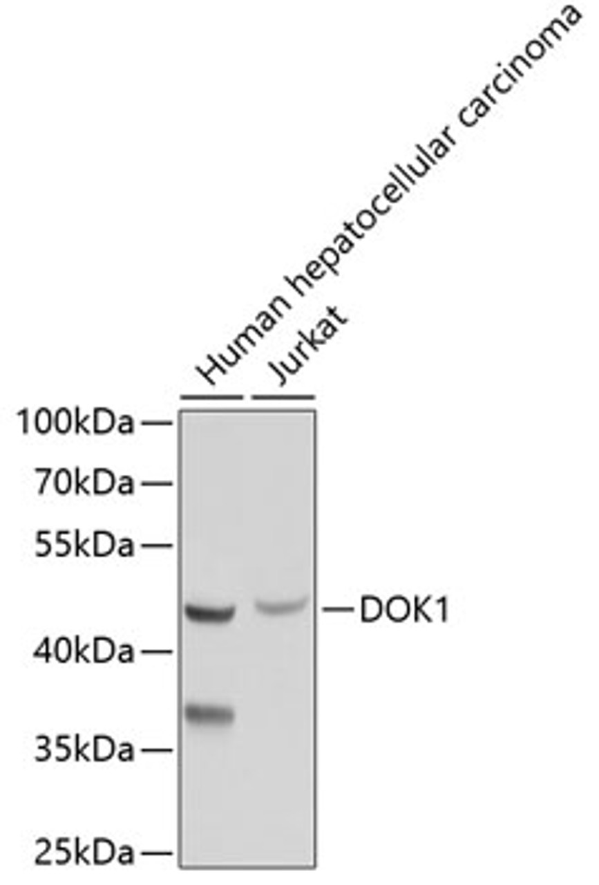Western blot analysis of extracts of various cell lines, using DOK1 antibody (18-783) .<br/>Secondary antibody: HRP Goat Anti-Rabbit IgG (H+L) at 1:10000 dilution.<br/>Lysates/proteins: 25ug per lane.<br/>Blocking buffer: 3% nonfat dry milk in TBST.