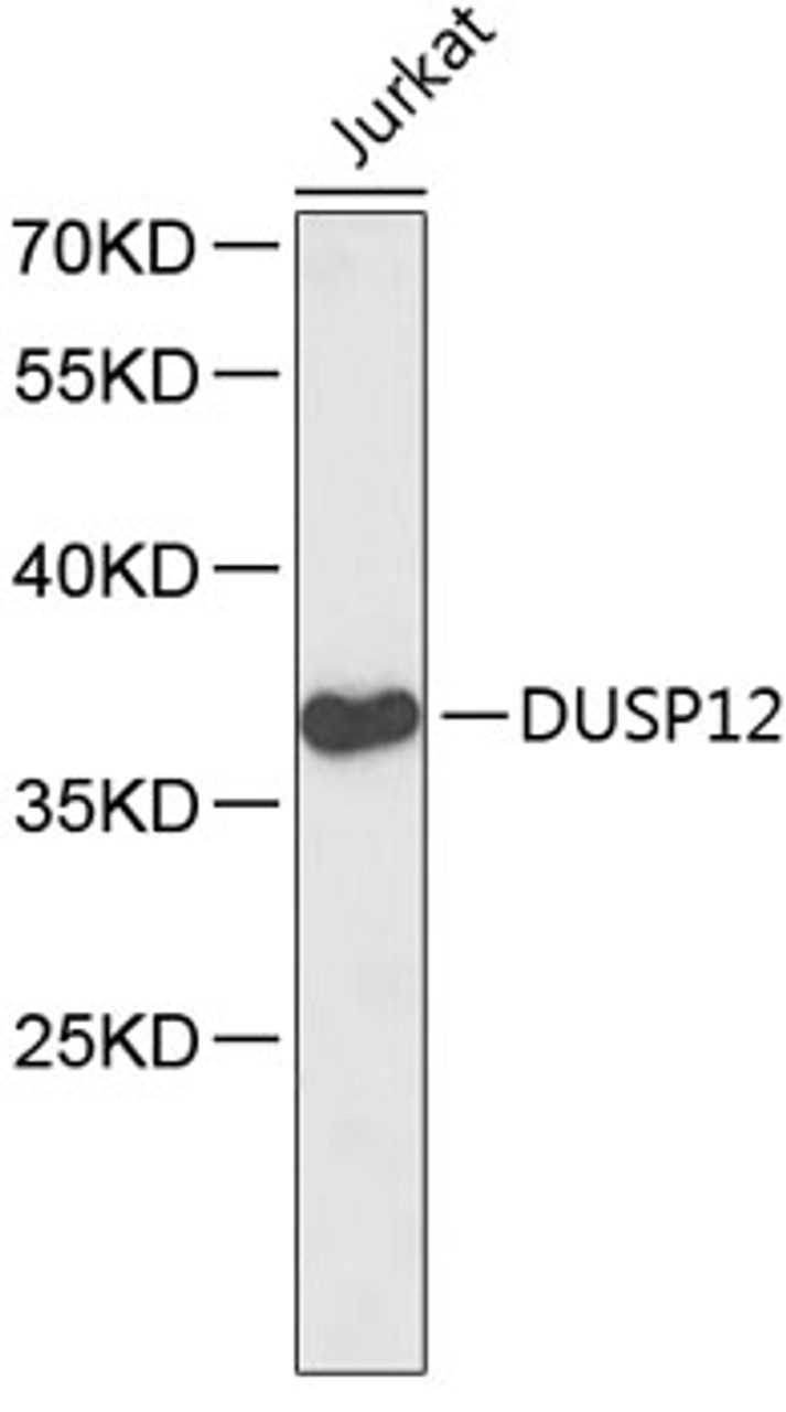 Western blot analysis of extracts of Jurkat cells, using DUSP12 antibody (18-789) .<br/>Secondary antibody: HRP Goat Anti-Rabbit IgG (H+L) at 1:10000 dilution.<br/>Lysates/proteins: 25ug per lane.<br/>Blocking buffer: 3% nonfat dry milk in TBST.