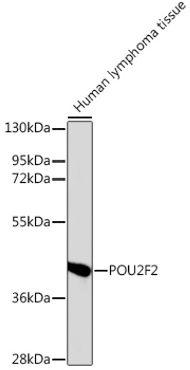 Western blot analysis of extracts of human lymphoma, using POU2F2 antibody (18-807) at dilution.<br/>Secondary antibody: HRP Goat Anti-Rabbit IgG (H+L) at 1:10000 dilution.<br/>Lysates/proteins: 25ug per lane.<br/>Blocking buffer: 3% nonfat dry milk in TBST.