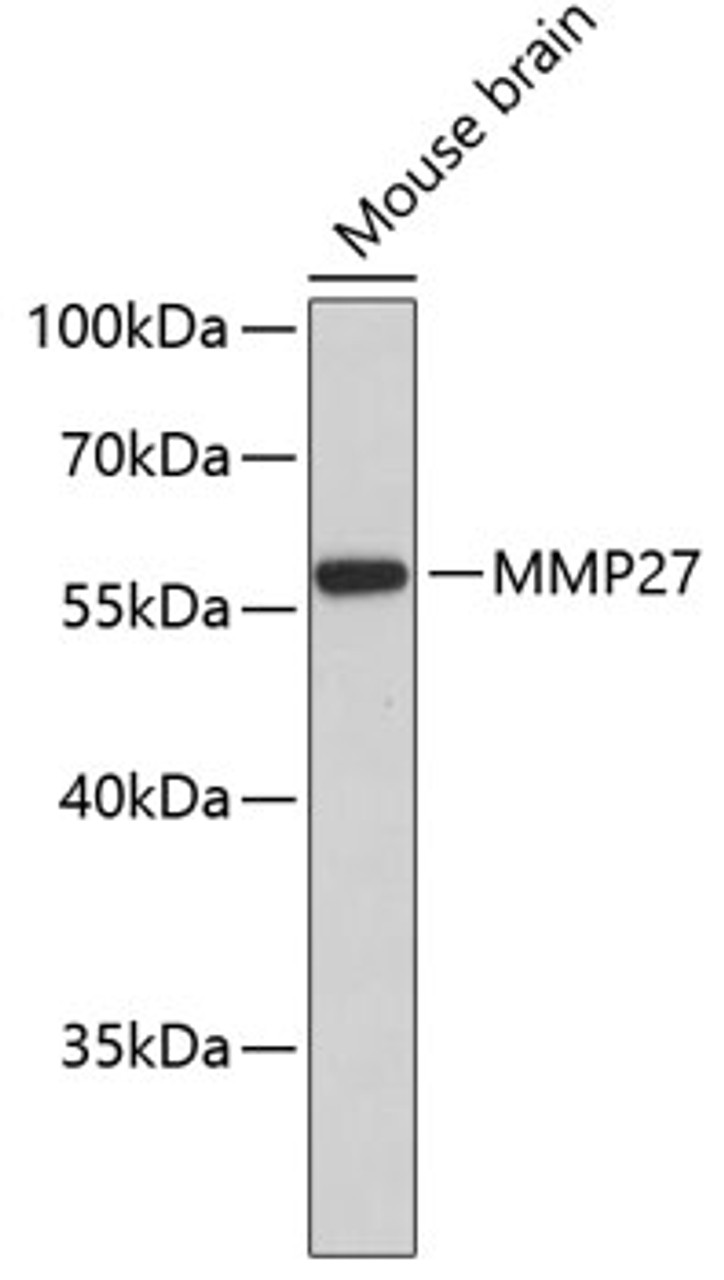 Western blot analysis of extracts of mouse brain, using MMP27 antibody (18-914) .<br/>Secondary antibody: HRP Goat Anti-Rabbit IgG (H+L) at 1:10000 dilution.<br/>Lysates/proteins: 25ug per lane.<br/>Blocking buffer: 3% nonfat dry milk in TBST.