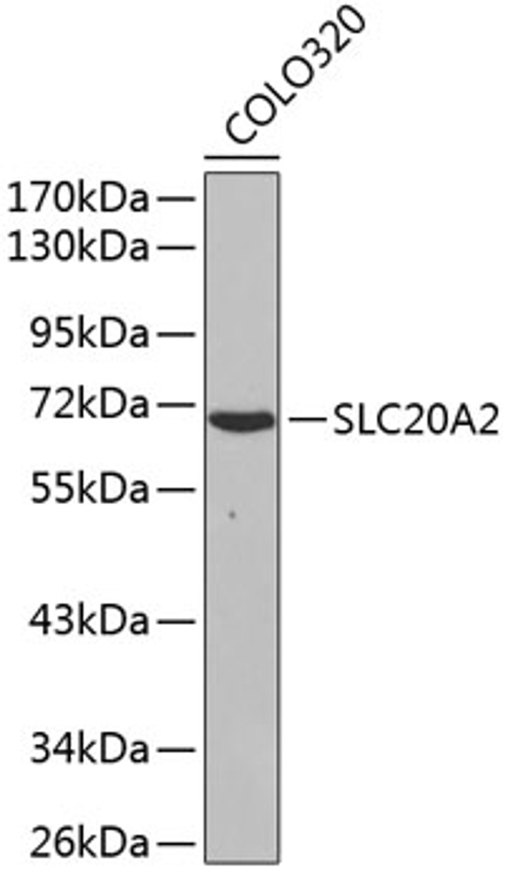 Western blot analysis of extracts of COLO320 cells, using SLC20A2 antibody (18-962) .<br/>Secondary antibody: HRP Goat Anti-Rabbit IgG (H+L) at 1:10000 dilution.<br/>Lysates/proteins: 25ug per lane.<br/>Blocking buffer: 3% nonfat dry milk in TBST.