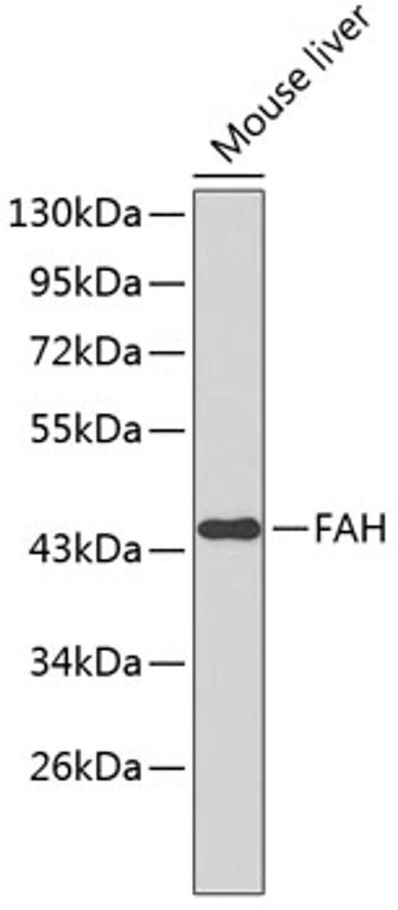 Western blot analysis of extracts of mouse liver, using FAH antibody (19-005) .<br/>Secondary antibody: HRP Goat Anti-Rabbit IgG (H+L) at 1:10000 dilution.<br/>Lysates/proteins: 25ug per lane.<br/>Blocking buffer: 3% nonfat dry milk in TBST.