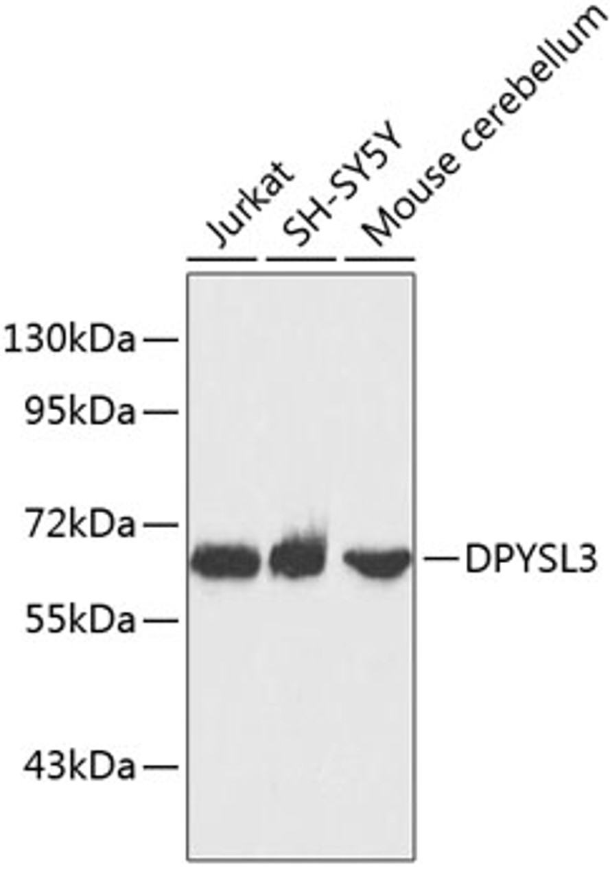 Western blot analysis of extracts of various cell lines, using DPYSL3 antibody (19-180) .<br/>Secondary antibody: HRP Goat Anti-Rabbit IgG (H+L) at 1:10000 dilution.<br/>Lysates/proteins: 25ug per lane.<br/>Blocking buffer: 3% nonfat dry milk in TBST.